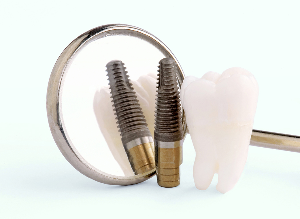 入れ歯とインプラント入れ歯の違い